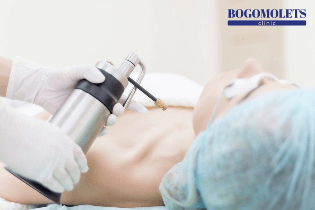 Видалення бородавок фото Bogomolets Clinic