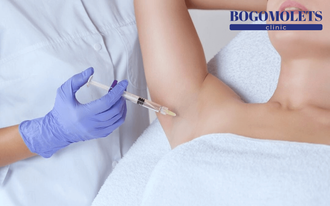 Лікування гіпергідрозу ботоксом фото Bogomolets Clinic