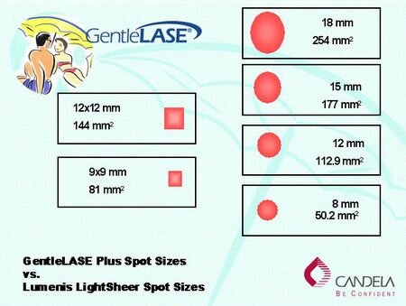 Порівняння Candela GentleLase та Lumenis LightSheer