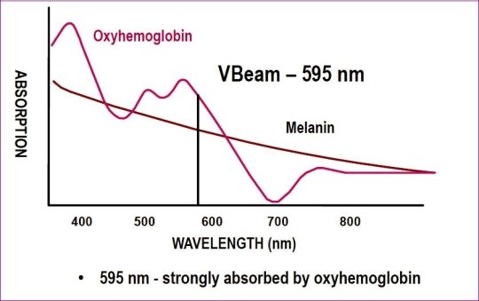 Лазер VBEAM PERFECTA, Candela Corp., USA