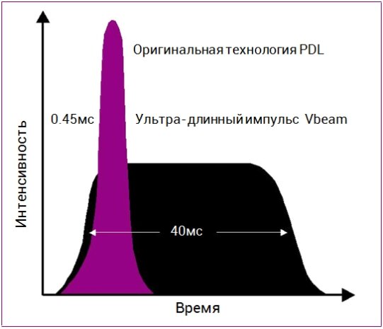 Лазер VBEAM PERFECTA, Candela Corp., USA